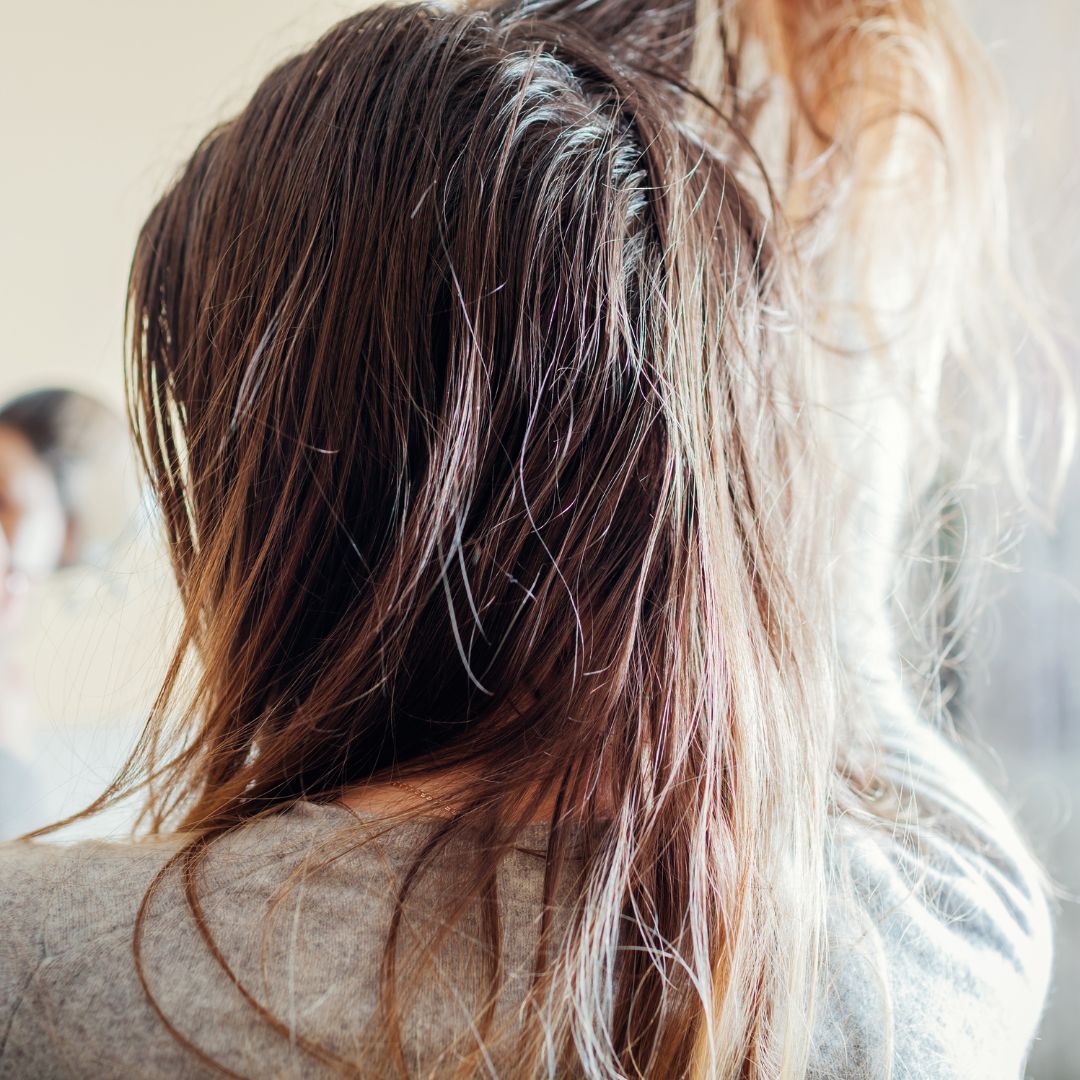 Cabello Graso en Raíz y Seco en Puntas